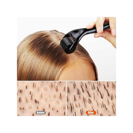Derma Roller And Oil