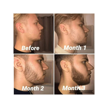 Derma Roller And Oil